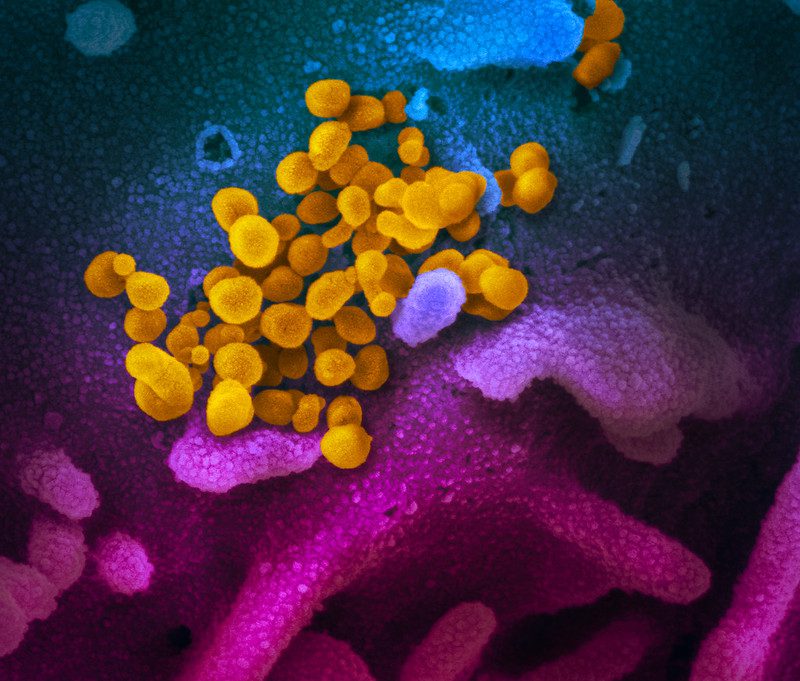 Image of Novel Coronavirus SARS-CoV-2