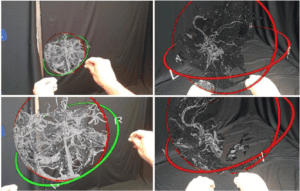 A pair of human hands manipulates a 3D hologram of a brain.
